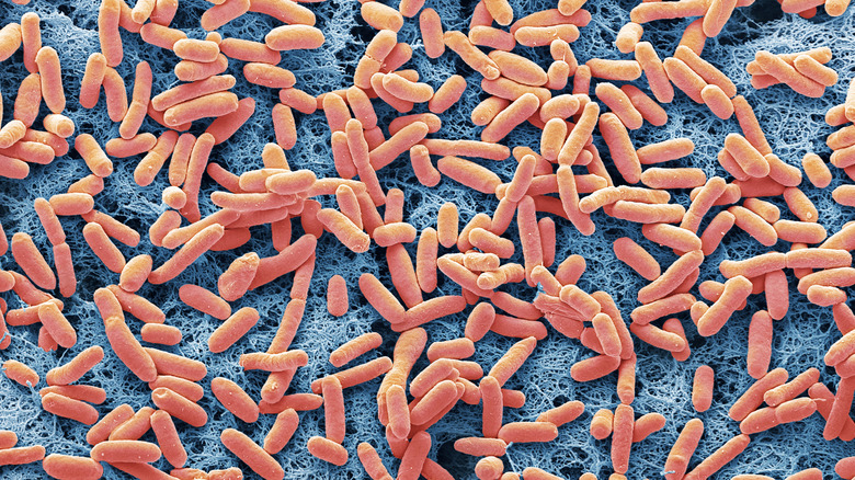 Colored scanning electron micrograph of E. coli bacteria