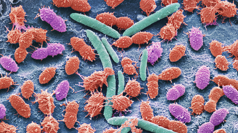 Scanning electron micrograph of human fecal microbiome