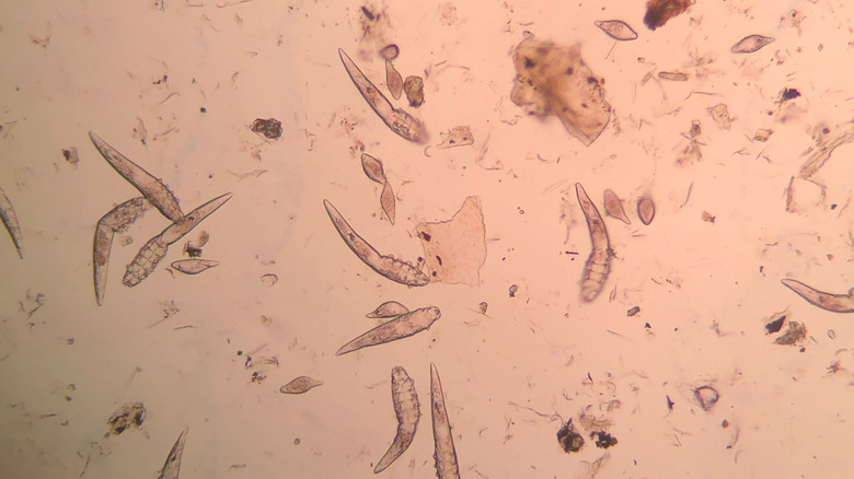 Demodex mites are seen under a microscope