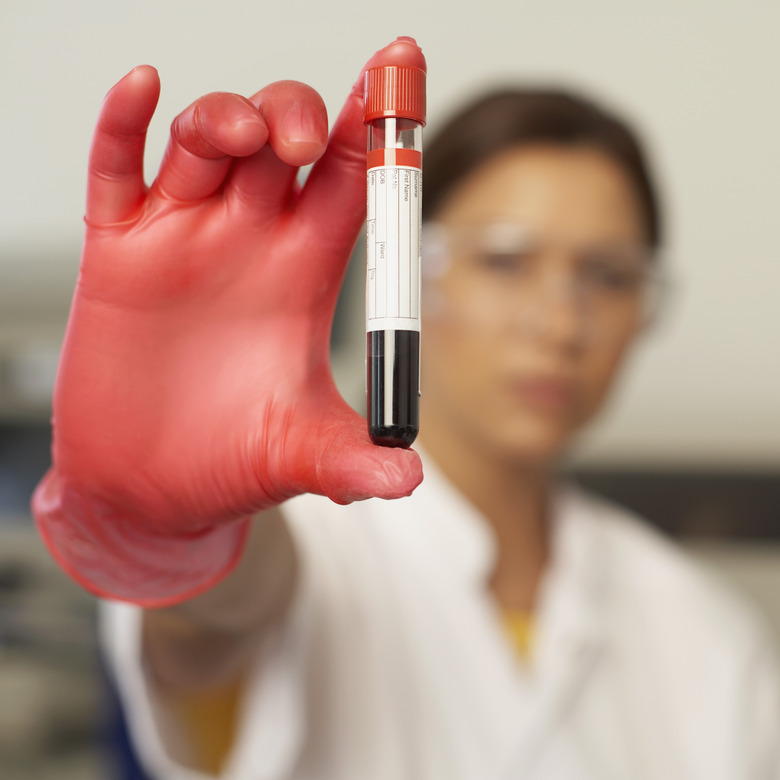 Hand with vial of blood