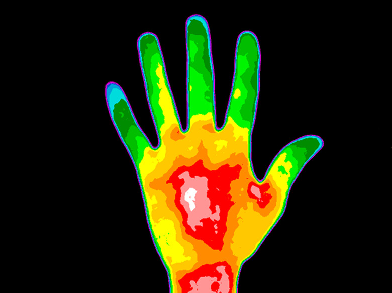 Thermography Hand Palm