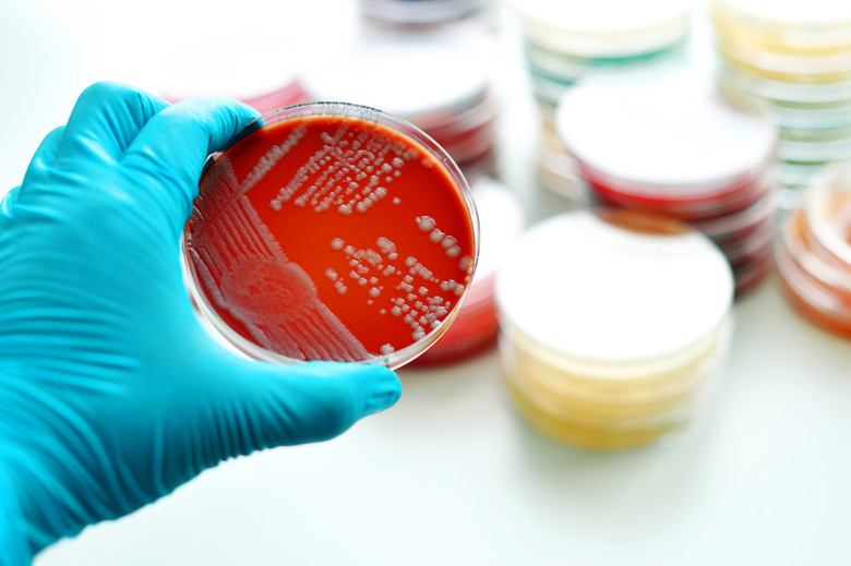 Bacteria culture plate - Agar Slants