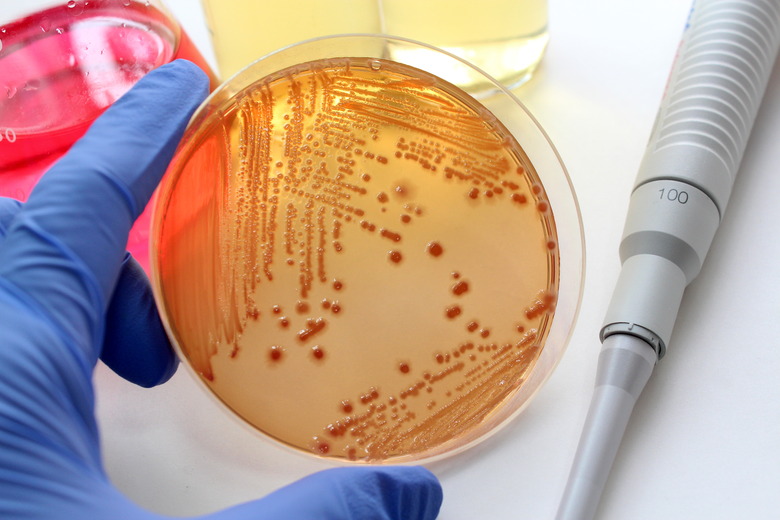 Microbiological examination