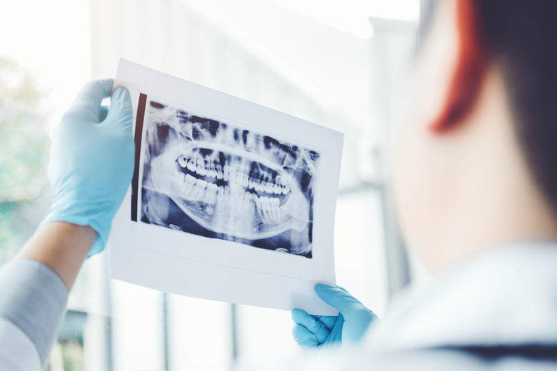 Dentist consulting with patient presenting results on Dental x-ray film About the problem of the patient