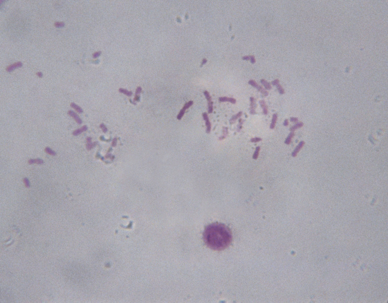 Microscope Image of Chromosomes