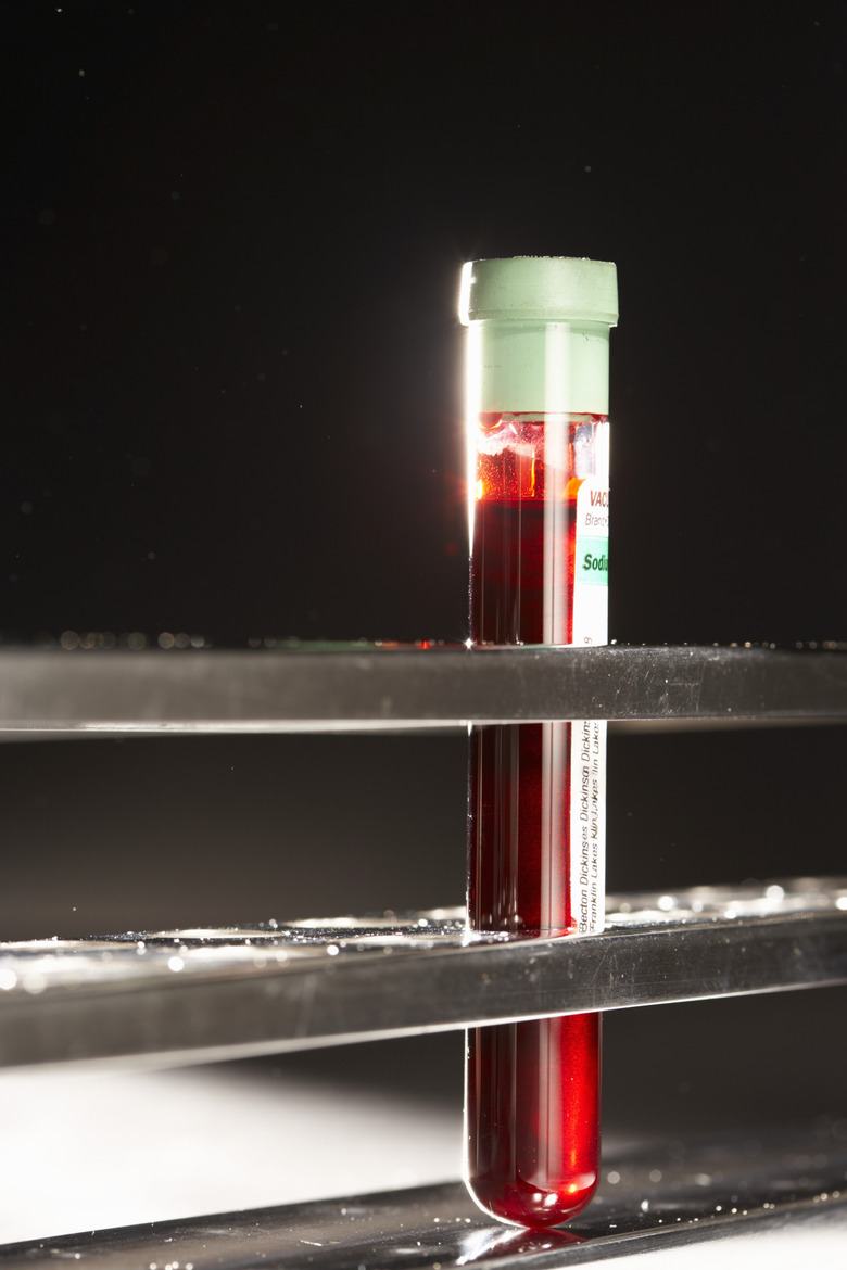 Test tube with blood sample