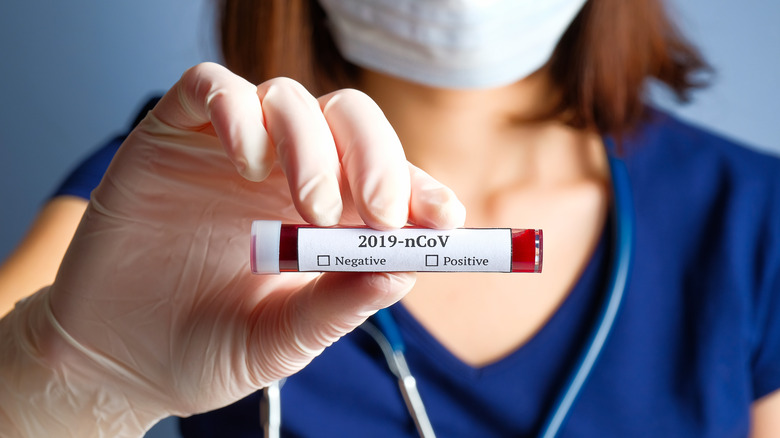 Nurse holding test tube with blood for 2019-nCoV analyzing. Novel Chinese Coronavirus blood test concept