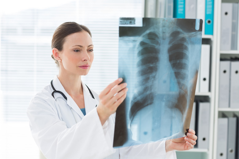 Doctor examining Xray report