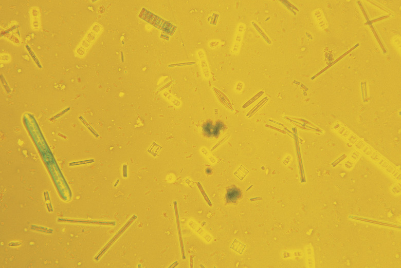 Mixed diatoms magnified 100x