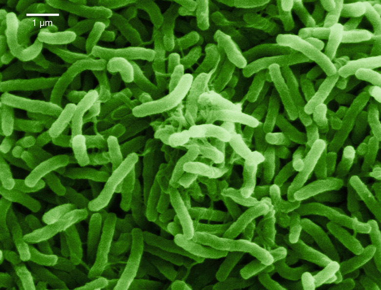 Scanning electron micrograph of Cholera bacteria