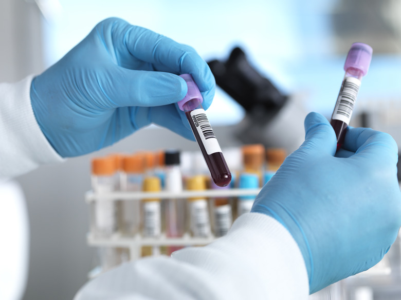 Hand holding blood sample in laboratory