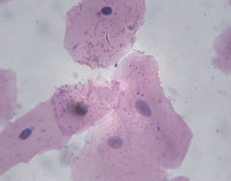 Microscopic Image of Squamis Epithelium