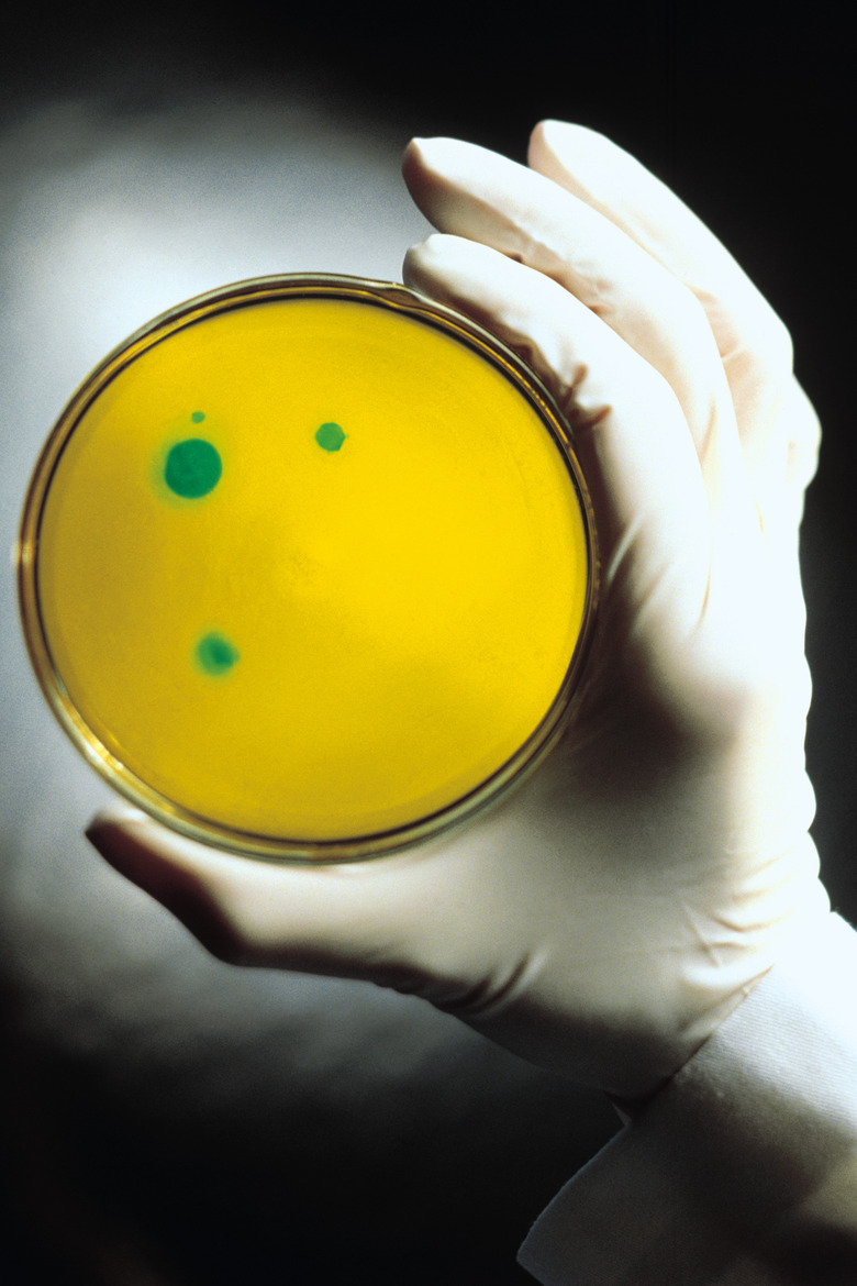 Hand holding Petri dish with microbial colonies