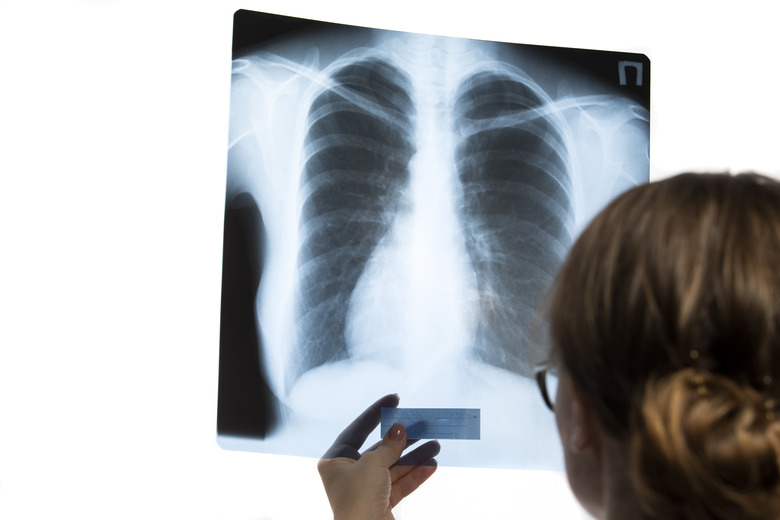 Medicine and Healthcare. Professional Radiologist Doctor Checking Patient Xray Film On Screen Against White. Horizontal Image Composition