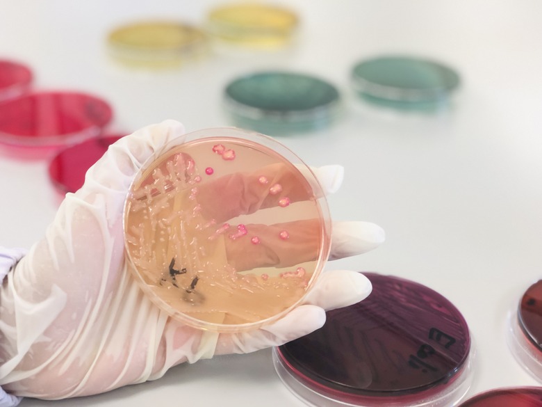 Mannitol salt agar (MSA Agar) in Petri dish used selective and differential growth medium in microbiology cultured Gram-positive bacteria (Staphylococcus and Micrococcaceae) Handle in scientist hands.