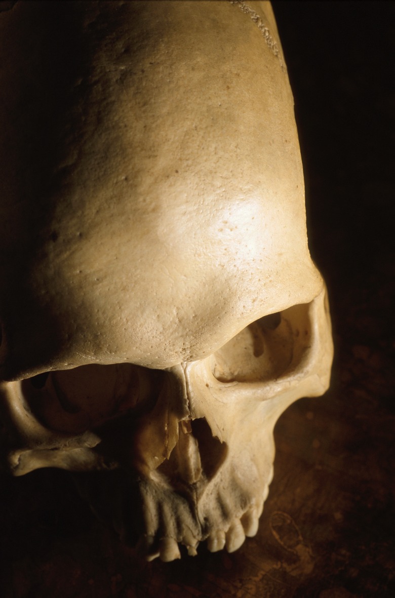 Skull