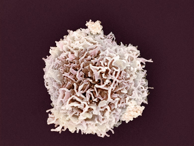 Scanning electron micrograph (SEM) of white blood cell