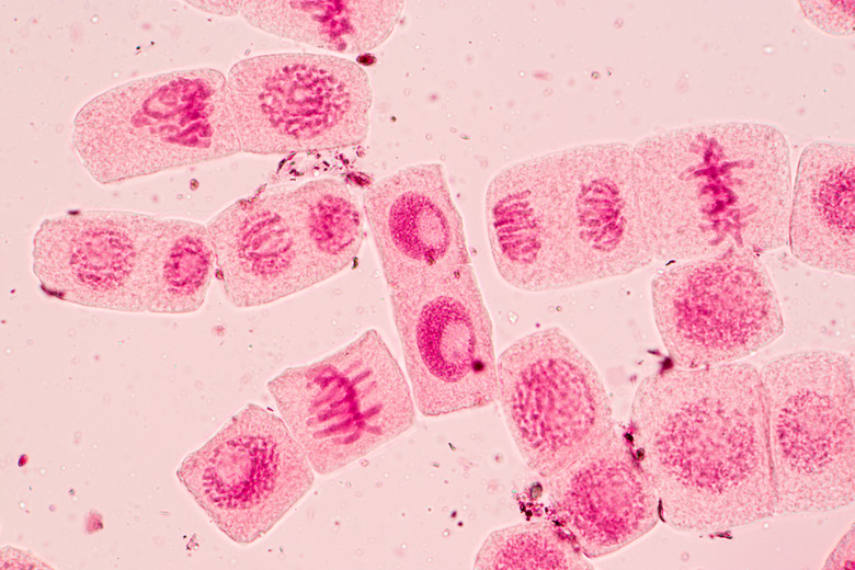 Root tip of Onion and Mitosis cell in the Root tip of Onion under a microscope.