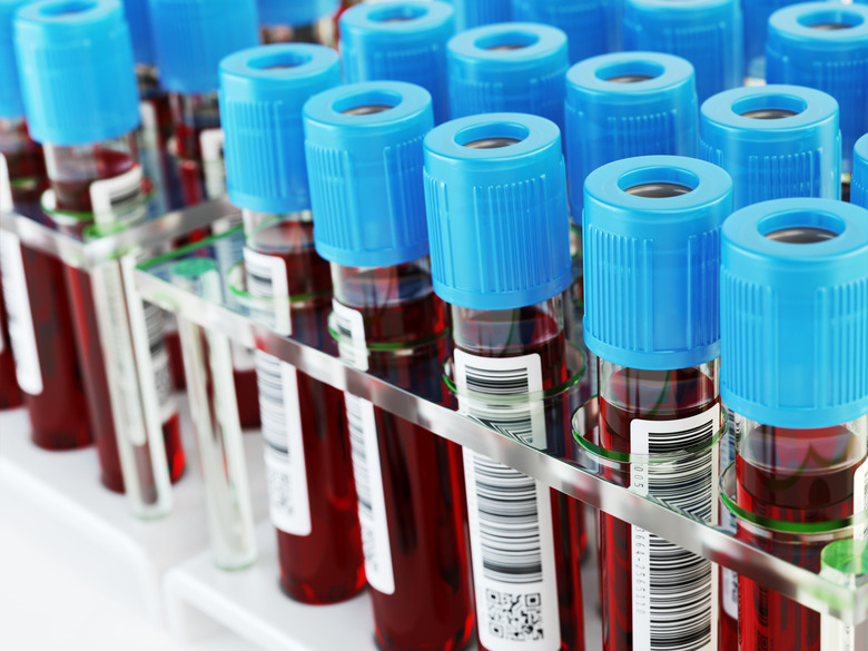 Blood test tubes. Samples in a rack.