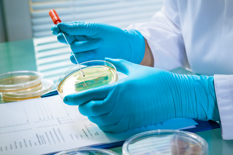 Agar plate with growing germs