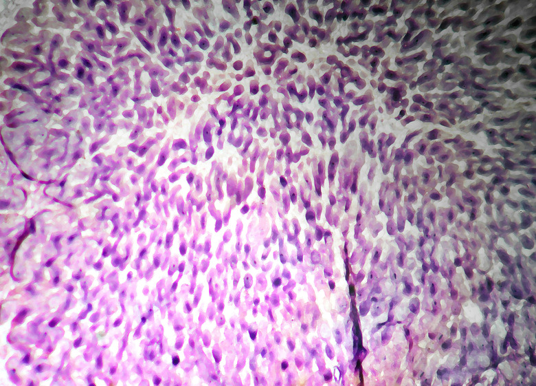 Cross section of bacteria