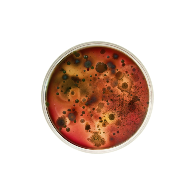 Bacteria growing in a petri dish