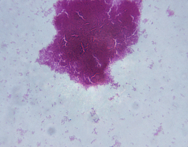 Microscopic Image of Agrobacterium Tumefaciens