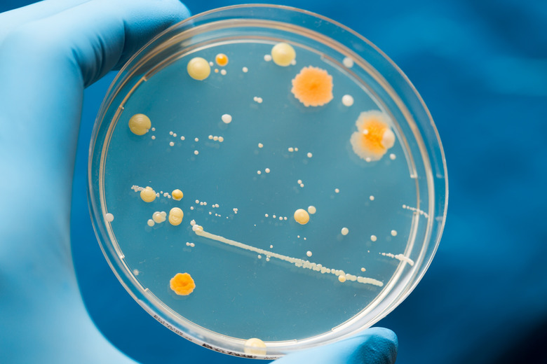 A petri dish with growing cultures of microorganisms, fungi and