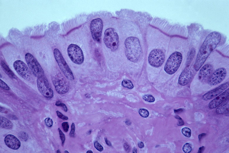 Organelle That Forms the Base for Cilia and Flagella