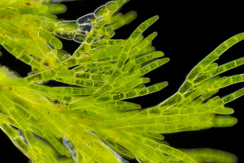 Microscopic view of green algae (Cladophora)