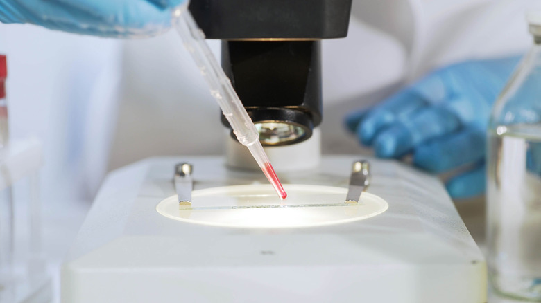 Biochemist preparing slide with blood sample, examines it under microscope