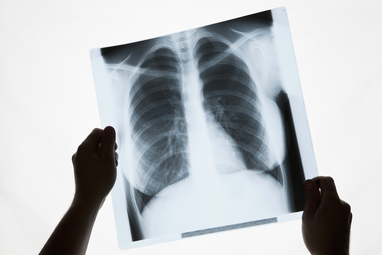 Hands holding a chest x-ray, close-up