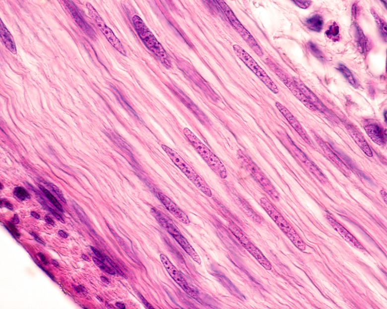 Smooth muscle cells