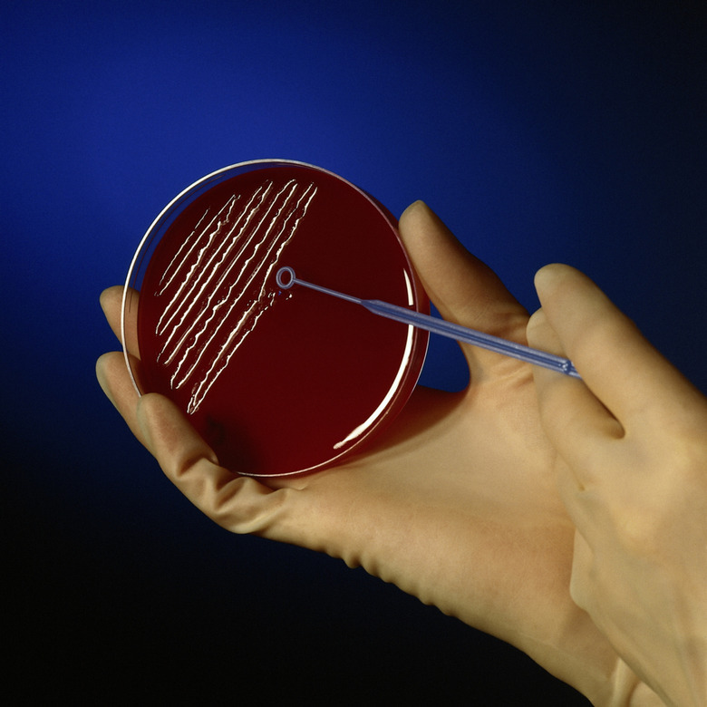 Scientist innoculating agar in petri dish with microbes