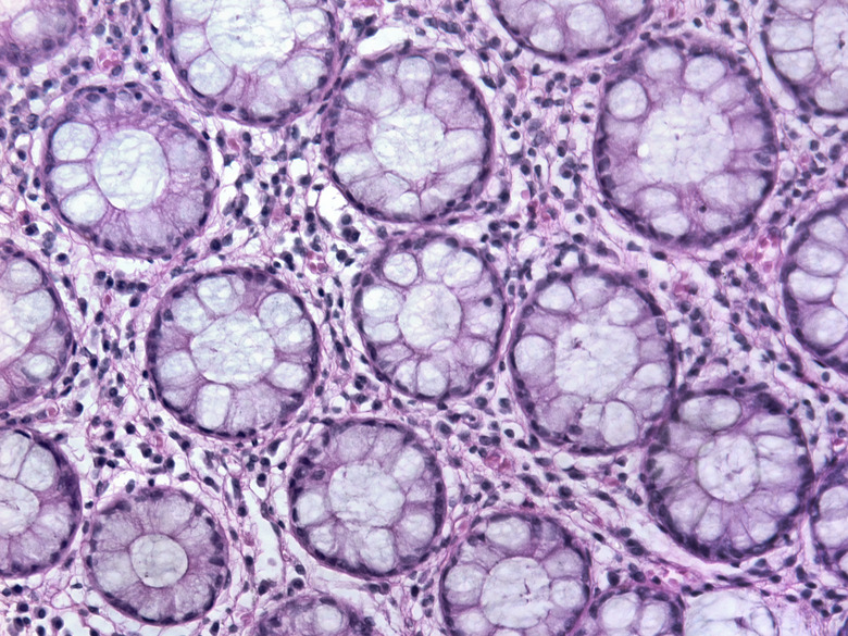 Glandular tissue at 20x Magnification