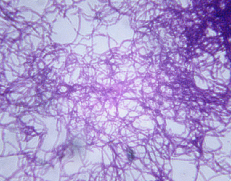 Microscopic Image of Bacillus Anthracis