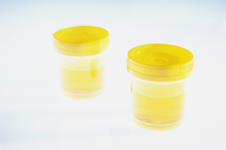 Two Urine Samples