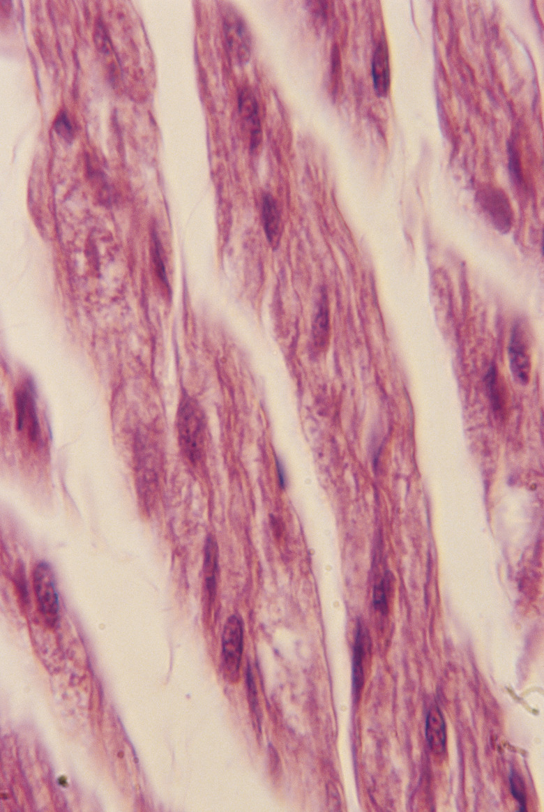 Human muscles cells magnified 200x