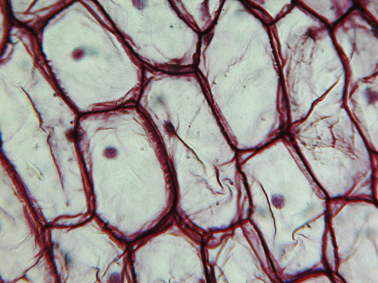 Onion epidermus micrograph