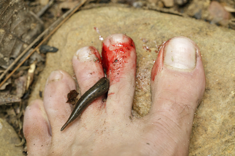 leech biting human foot